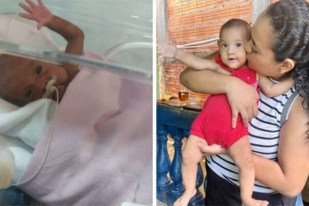 Imagem da bebê Thuany Almeida, recuperada após parto prematuro - Metrópoles