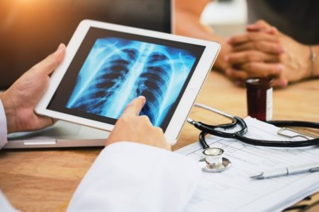 Médico segura tablet para mostrar câncer de pulmão em exame de paciente - Metrópoles