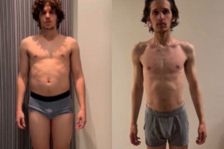 Homem saudável e homem excessivamente magro - Antes e depois de Andy Pruss durante gravações de A Sociedade da Neve - Metrópoles