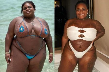 montagem com fotos de antes e depois de Jojo Todynho - metrópoles