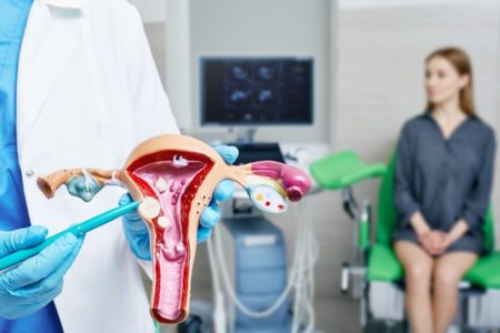 Médico mostra útero com miomas. Paciente está sentada ao fundo - Metrópoles