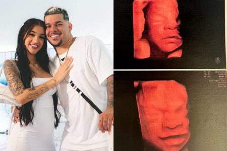 montagem com foto de bia miranda e rafael buarque e foto de rosto de bebê em ultrassom - metrópoles