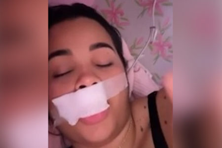 imagem colorida modelo tem parte do labio arrancado ao beijar cachorro - Metrópoles