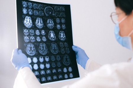 Médico olhando raio-x cerebral. Alzheimer. Metrópoles - declínio cognitivo