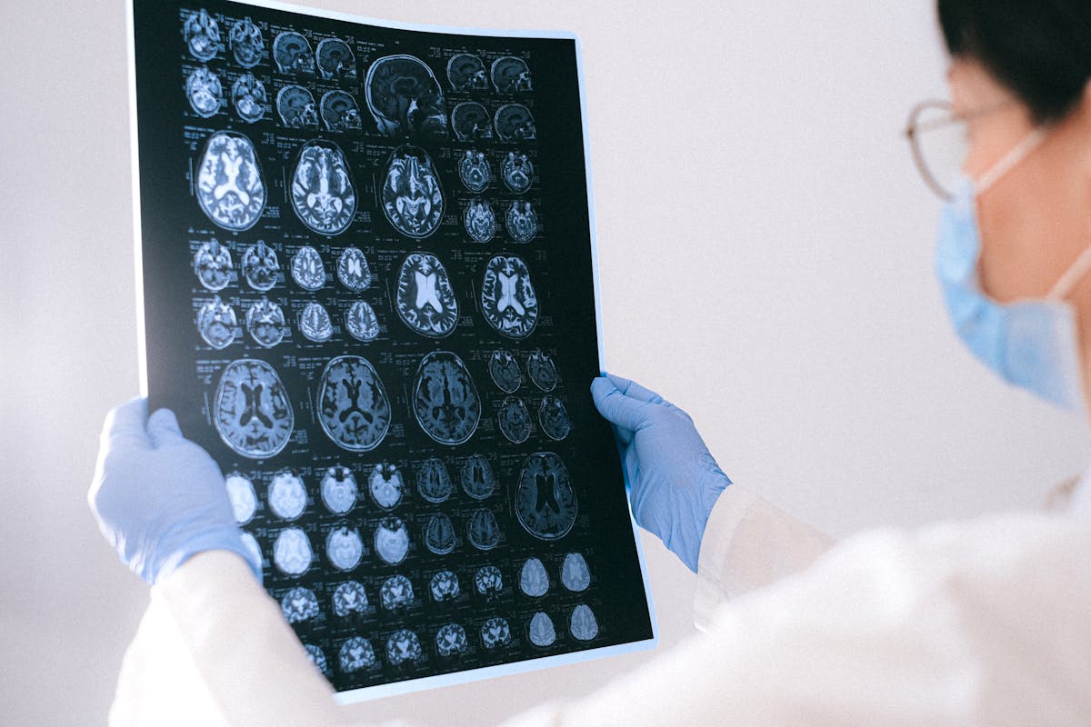 Médico olhando raio-x cerebral. Alzheimer. Metrópoles - declínio cognitivo