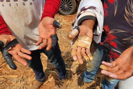 Imagem colorida de mãos de trabalhadores em condições análogas à escravidão - Metrópoles