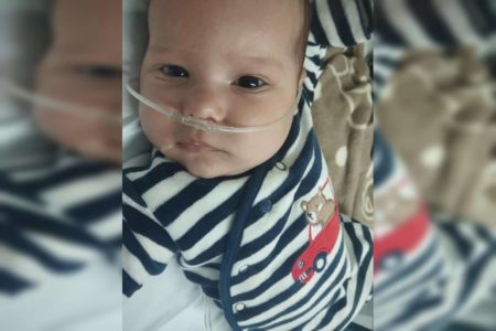 Foto colorida de bebê deitado com dreno no nariz