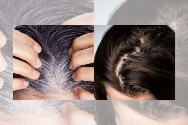 Foto colorida de um cabelo branco receita - Metrópoles