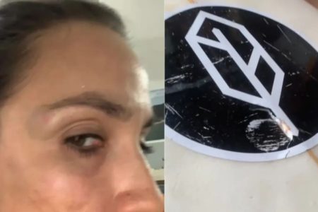 Arte com fotos de rosto de uma mulher com marcas de agressão e um pranche de surfe danificada - Metrópoles