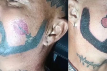 Tatuagem de barba passou por uma restauração - Metrópoles