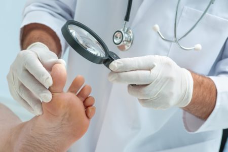 Médico dermatologista examina o pé quanto à presença de fungos