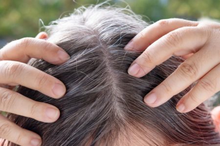 Foto colorida de um cabelo branco - Metrópoles