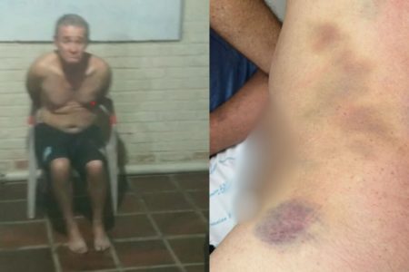 Duas fotos coloridas. Esquerda homem semi nu amarrado em cadeira. Outro lado torso com hematomas - Metrópoles