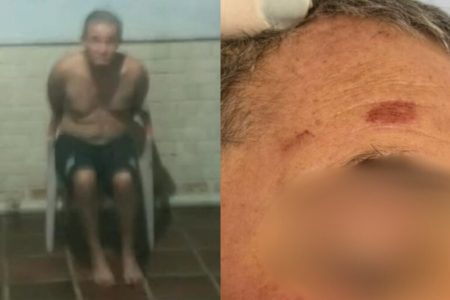 Duas fotos coloridas. Esquerda homem semi nu amarrado em cadeira. Na outra, testa ferida com hematomas - Metrópoles