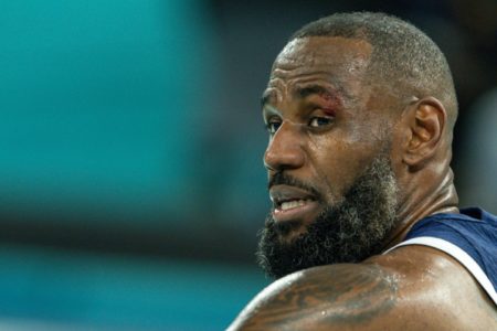 Imagem colorida de Le Bron James após falta que causou corte no supercílio- Metrópoles