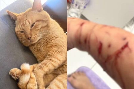 Caso Thor: gato que dilacerou o braço de tutora em São Vicente foi diagnosticado com desconforto emocional por causa de Síndrome de Pandora - Metrópoles
