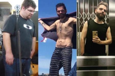 Foto mostra Nando Castros, homem branco de barba, que fez cirurgia bariátrica e teve estenose - Metrópoles