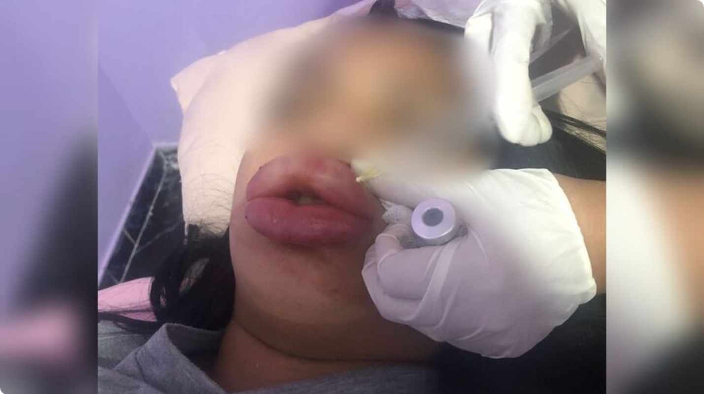 vítima de falsa esteticista