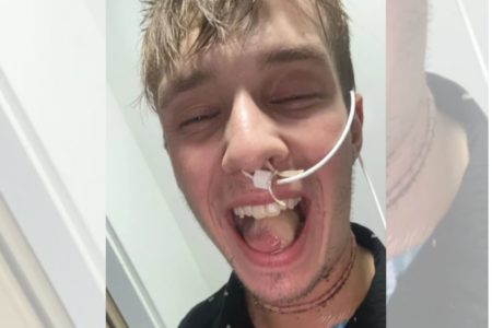 Homem loiro com sonda no nariz mostra a língua - Metrópoles