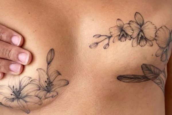 Por ano, são estimados 20.470 casos de câncer de mama em SP. Tatuagens e reconstruções são opções para mulheres resgatarem sua auto-estima - Metrópoles
