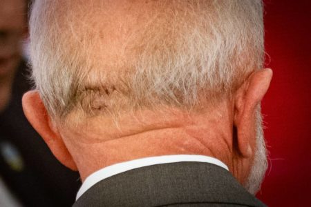 Imagem colorida de pontos na cabeça do presidente Lula -- Metrópoles