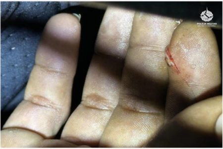 A Polícia Militar do Distrito Federal (PMDF) prendeu, na madrugada desta terça-feira (31/12), quatro suspeitos de roubo e tentativa de homicídio em Ceilândia. O crime ocorreu na Rua 11, Condomínio Privê Módulo 11, por volta das 00h30, quando um homem de 33 anos teve seu veículo roubado e foi esfaqueado.