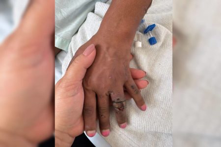 Mãos femininas, uma branca e uma negra, se apoiam. A mão negra está ferida, com unha pintada - Metrópoles