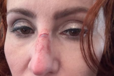 Carla Zambelli machucada após ser atingida por painel em avião