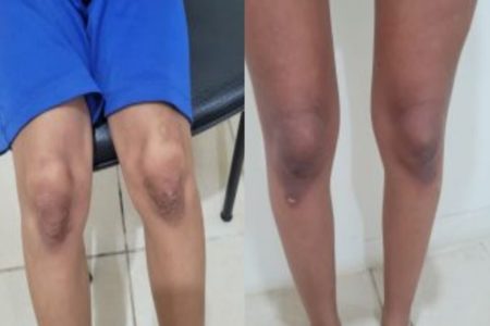 Imagem colorida, MT: duas mulheres são presas por torturarem adolescente e criança - Metrópoles