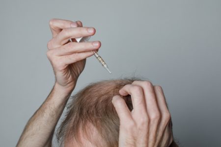 Homem careca segurando conta-gotas de minoxidil ou óleo essencial em close