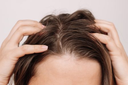Mulher com mãos no cabelo oleoso - Metrópoles