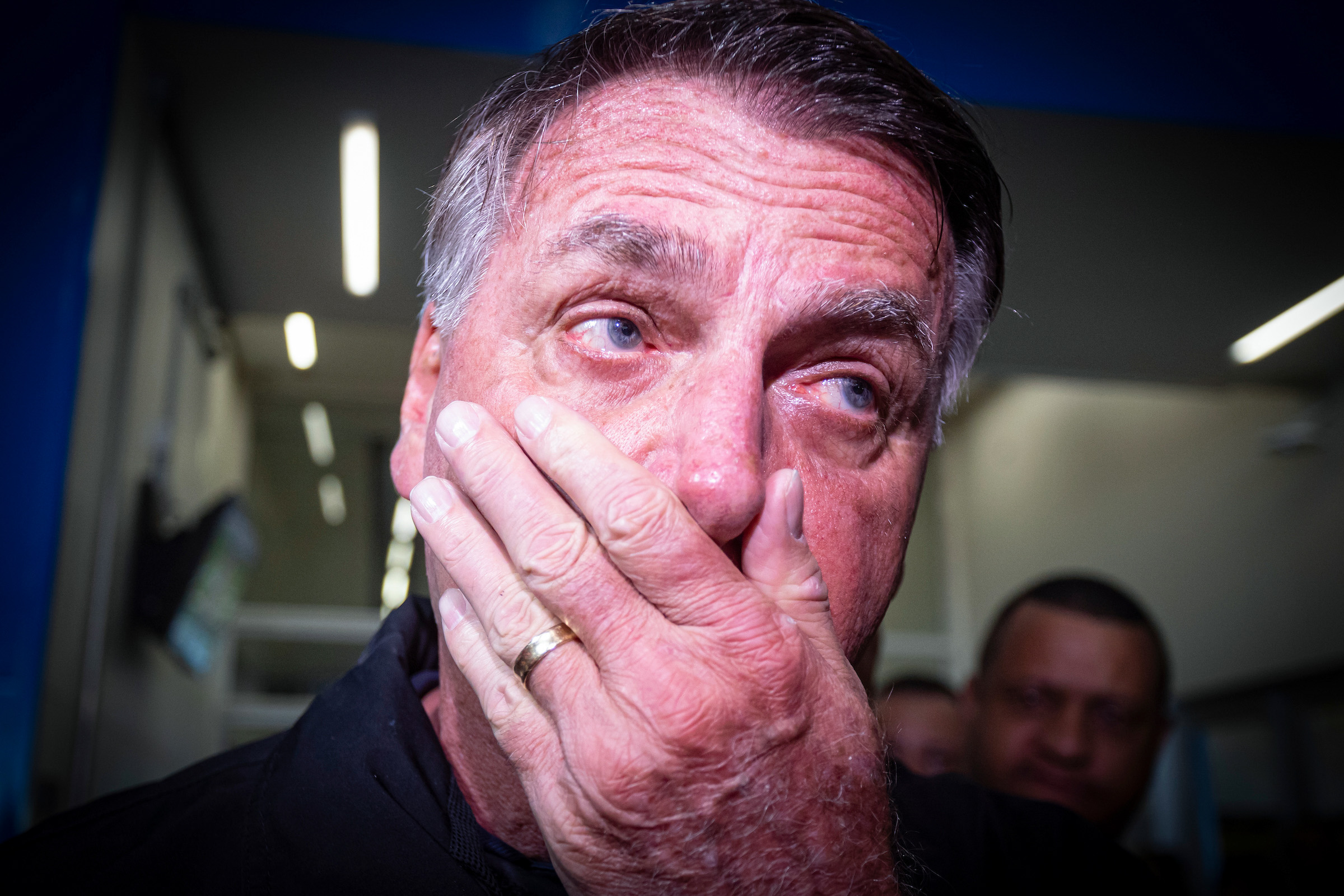 Ex-presidente da República Jair Bolsonaro PL com a mão no rosto Metrópoles