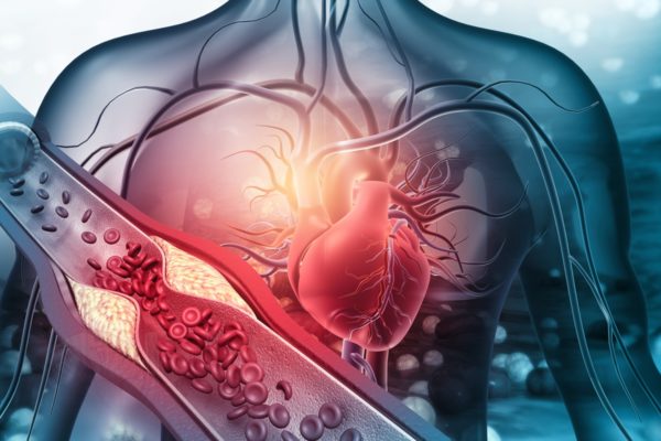 Ilustração de sistema cardiovascular - Metrópoles
