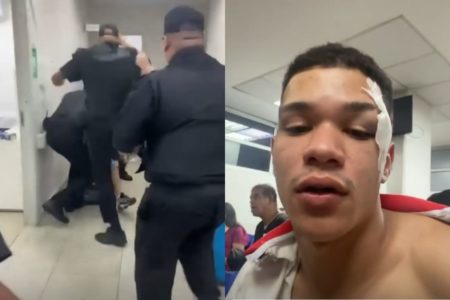 Imagem colorida de paciente agredido em UPA