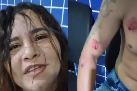 Mulher se revolta ao flagrar traição e morde marido e amante