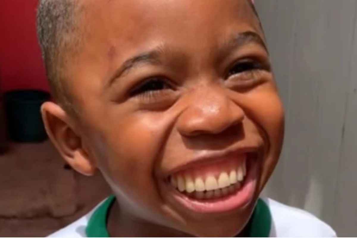 Foto colorida de menino pequeno com dentadura na boca- Metrópolis